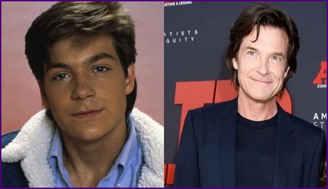 Jason Bateman Plastic Surgery Before and After
